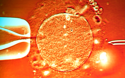 Intracytoplasmic sperm injection (ICSI)
