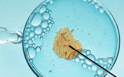 IVF atau Fertilisasi In Vitro