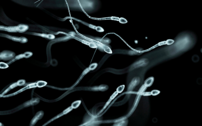 Microepididymal Sperm Aspiration (MESA)