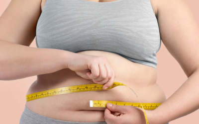 Benarkah Obesitas Morbid dapat Berdampak Negatif pada Kesuburan?