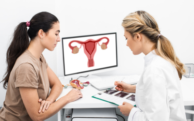 Jenis-jenis Kista Ovarium