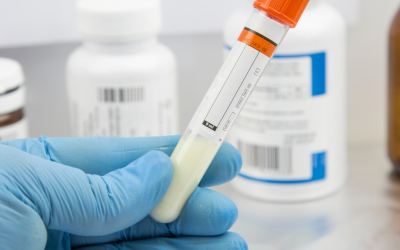 Seperti Apakah Pemeriksaan Sperma?